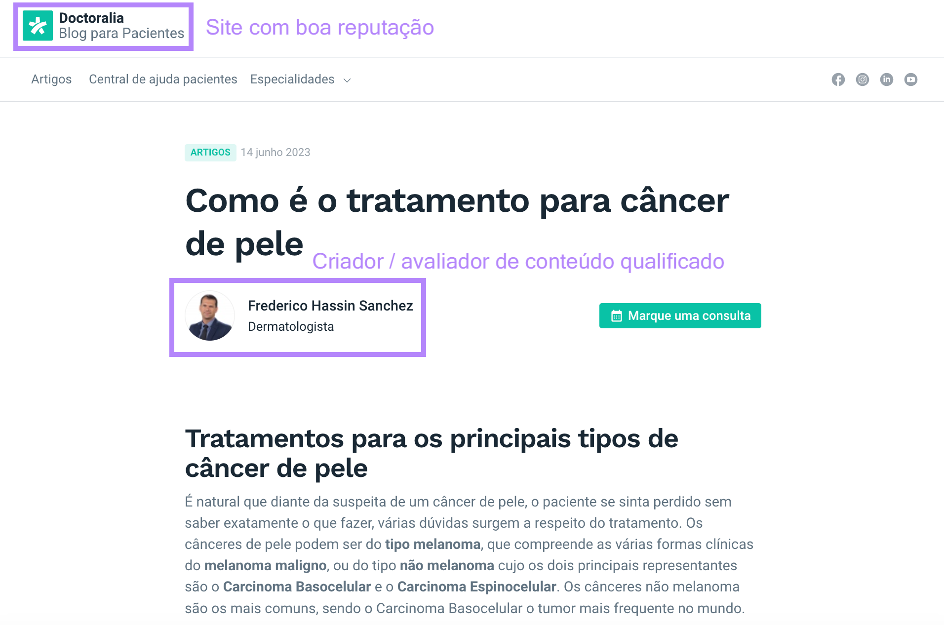 Um artigo sobre câncer de pele do Doctoralia como exemplo de autoridade